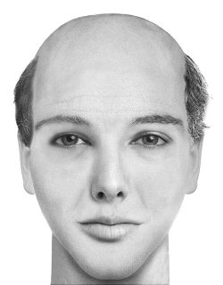 Иллюстрация к книге — Комплексная визуальная диагностика [i_305.jpg]