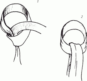 Иллюстрация к книге — Современные узлы для галстуков, шарфов, парео [_16.jpg]