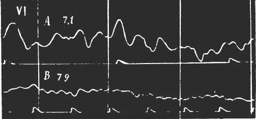 Иллюстрация к книге — Иллюстрированная история суеверий и волшебства [i_090.jpg]