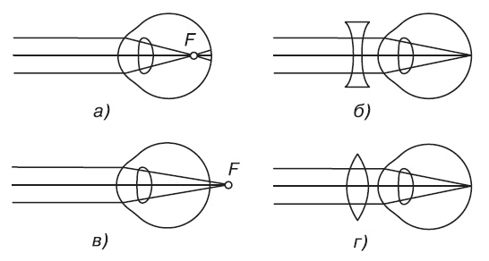 Иллюстрация к книге — Болезни глаз [i_004.jpg]