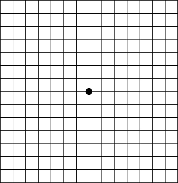 Иллюстрация к книге — Зрение. Советы и рекомендации ведущих врачей [_401.jpg]