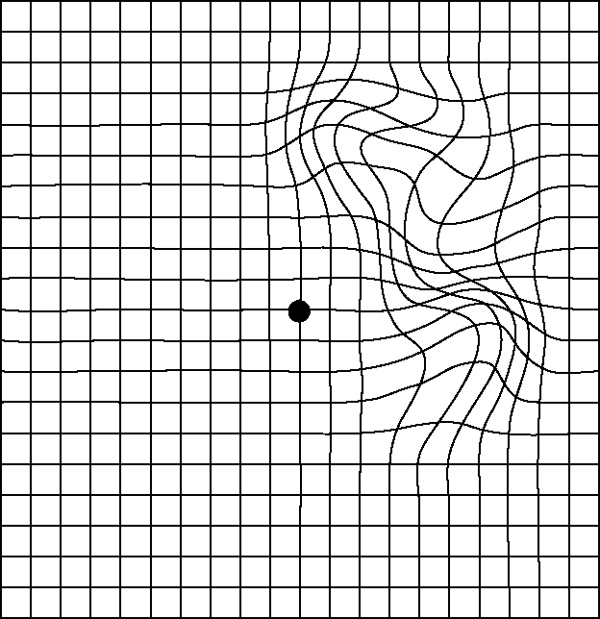 Иллюстрация к книге — Зрение. Советы и рекомендации ведущих врачей [_402.jpg]