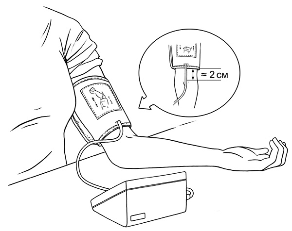 Иллюстрация к книге — Давление. Советы и рекомендации ведущих врачей [i_005.jpg]