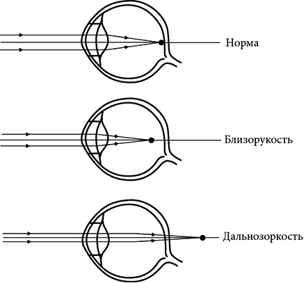 Иллюстрация к книге — Как снять очки за 10 занятий без операции [_073.jpg]