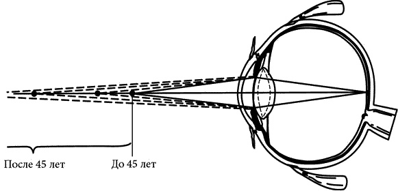 Иллюстрация к книге — Как снять очки за 10 занятий без операции [_074.jpg]
