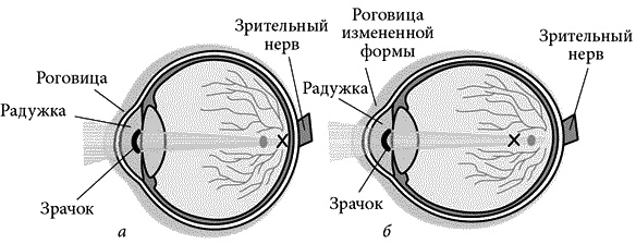 Иллюстрация к книге — Как снять очки за 10 занятий без операции [_075.jpg]