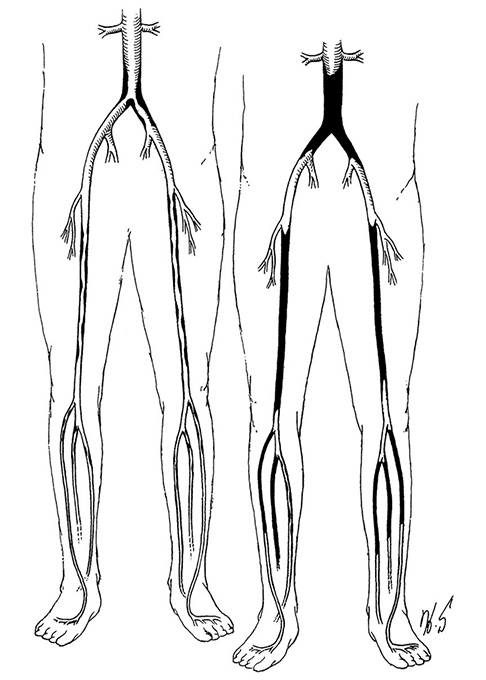 Иллюстрация к книге — Здоровое сердце. Издание XXI века [i_030.jpg]