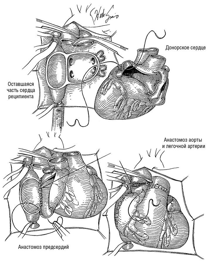 Иллюстрация к книге — Здоровое сердце. Издание XXI века [i_042.jpg]