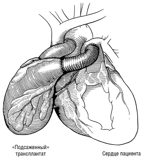 Иллюстрация к книге — Здоровое сердце. Издание XXI века [i_043.jpg]