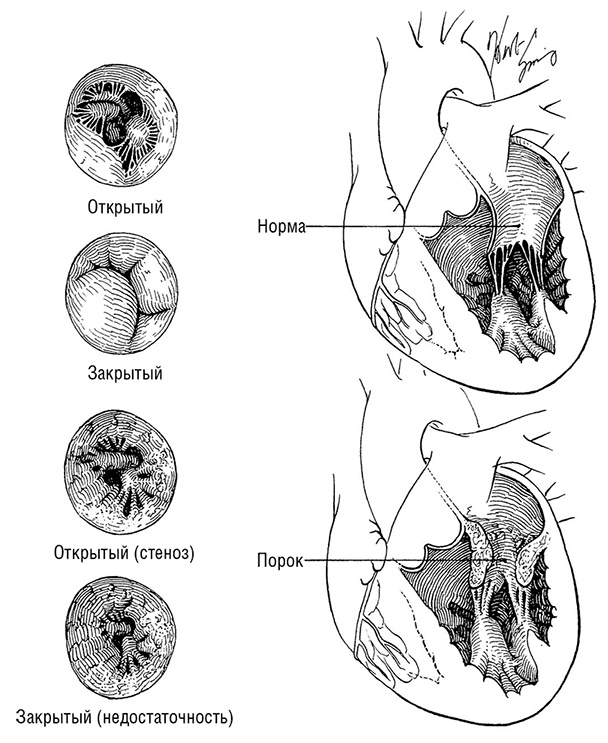 Иллюстрация к книге — Здоровое сердце. Издание XXI века [i_045.jpg]