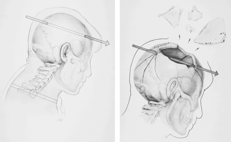 Иллюстрация к книге — Анатомия убийства. Гибель Джона Кеннеди. Тайны следствия [i_083.jpg]