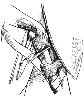 Иллюстрация к книге — Археология оружия. От бронзового века до эпохи Ренессанса [i_149.jpg]