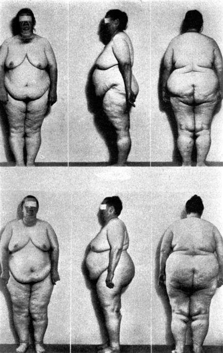 Иллюстрация к книге — Почему мы толстеем. Мифы и факты о том, что мешает нам быть стройными [_004.jpg]