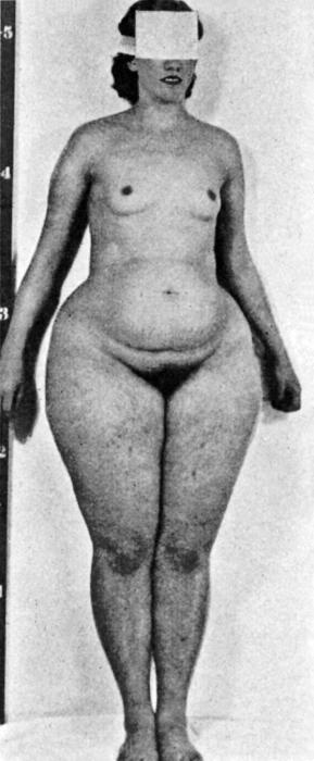 Иллюстрация к книге — Почему мы толстеем. Мифы и факты о том, что мешает нам быть стройными [_007.jpg]