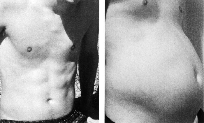 Иллюстрация к книге — Почему мы толстеем. Мифы и факты о том, что мешает нам быть стройными [_008.jpg]