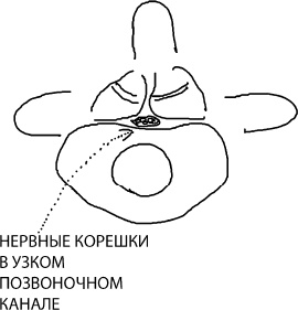Иллюстрация к книге — Большая книга упражнений для спины. Комплекс "Умный позвоночник" [_11.jpg]