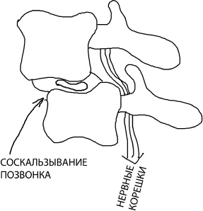 Иллюстрация к книге — Большая книга упражнений для спины. Комплекс "Умный позвоночник" [_13.jpg]