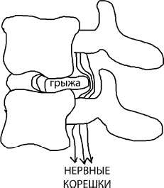 Иллюстрация к книге — Большая книга упражнений для спины. Комплекс "Умный позвоночник" [_7.jpg]