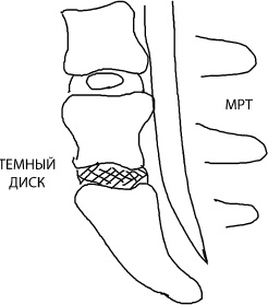 Иллюстрация к книге — Большая книга упражнений для спины. Комплекс "Умный позвоночник" [_8.jpg]