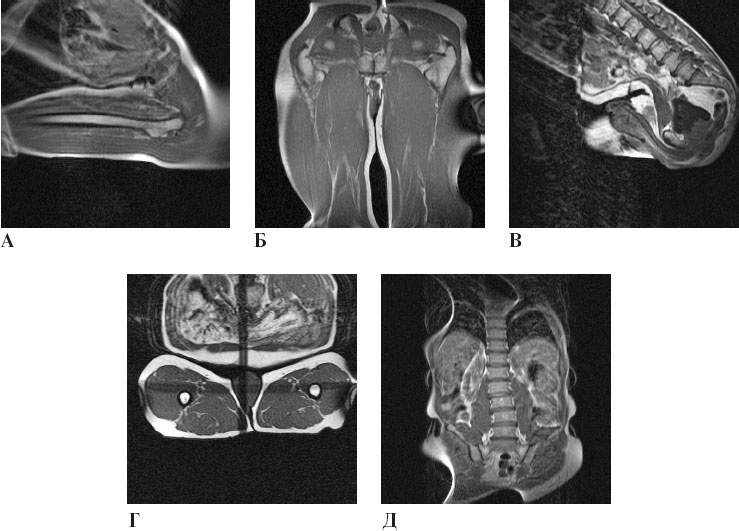 Иллюстрация к книге — Йога при остеопорозе [_108.jpg]