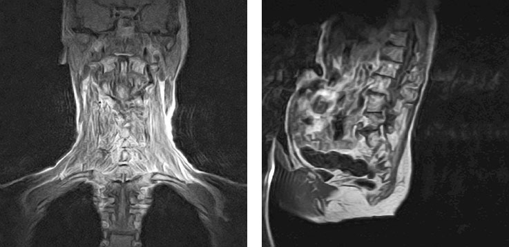 Иллюстрация к книге — Йога при остеопорозе [_184.jpg]