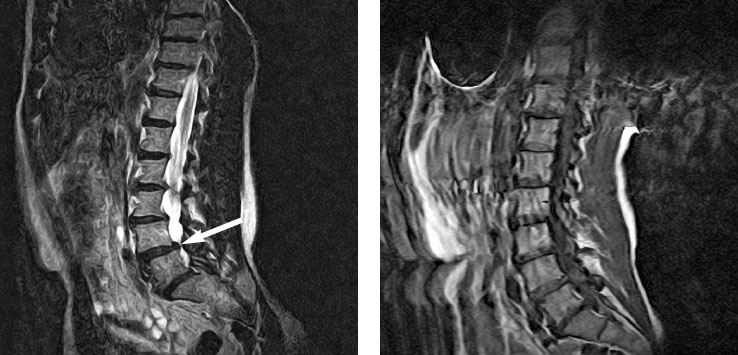 Иллюстрация к книге — Йога при остеопорозе [_256.jpg]