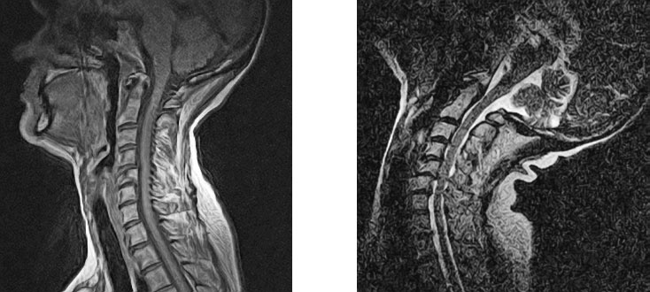Иллюстрация к книге — Йога при остеопорозе [_28.jpg]