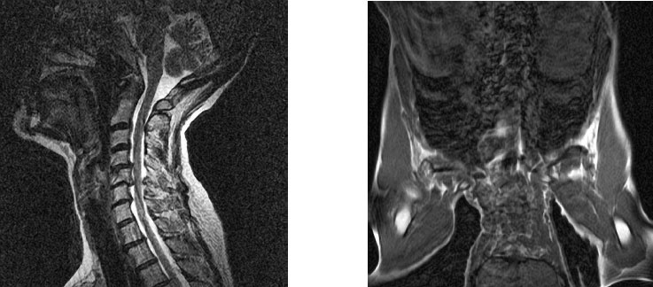 Иллюстрация к книге — Йога при остеопорозе [_295.jpg]
