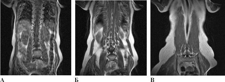Иллюстрация к книге — Йога при остеопорозе [_64.jpg]