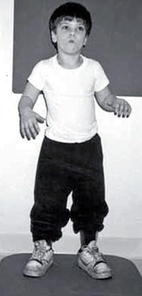 Иллюстрация к книге — Обучение моторным навыкам детей с ДЦП. Пособие для родителей и профессионалов [i_209.jpg]