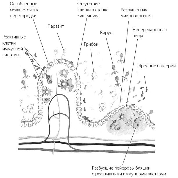 Иллюстрация к книге — Программа «Здоровый кишечник». Как здоровье организма зависит от пищеварения [i_003.jpg]