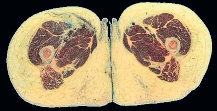 Иллюстрация к книге — Я тоже была толстой [i_007.jpg]