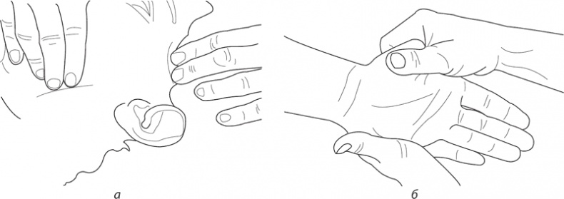 Иллюстрация к книге — Атлас. Практический массаж [i_108.jpg]