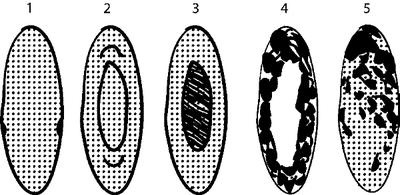 Иллюстрация к книге — Болезни глаз: глаукома и катаракта. Карманный справочник [i_003.jpg]