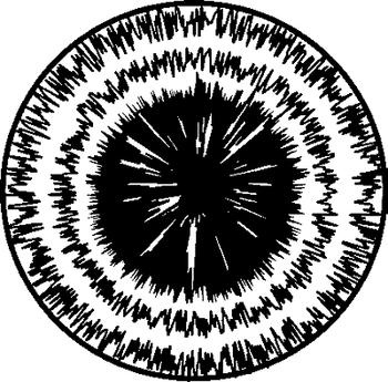 Иллюстрация к книге — Болезни глаз: глаукома и катаракта. Карманный справочник [i_004.jpg]