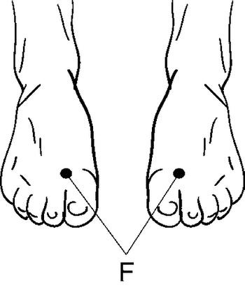 Иллюстрация к книге — Болезни глаз: глаукома и катаракта. Карманный справочник [i_007.jpg]