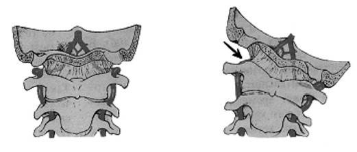 Иллюстрация к книге — Ария для спины. Авторская программа против боли в суставах [i_024.jpg]