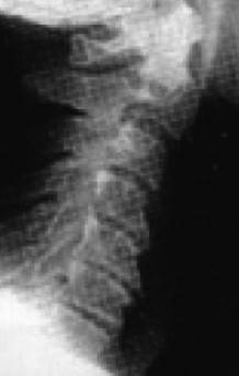 Иллюстрация к книге — Биогимнастика для лица: система фейсмионика [i_018.jpg]