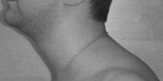 Иллюстрация к книге — Биогимнастика для лица: система фейсмионика [i_021.jpg]