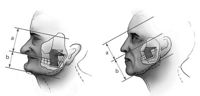 Иллюстрация к книге — Биогимнастика для лица: система фейсмионика [i_033.jpg]