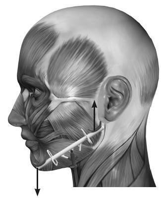 Иллюстрация к книге — Биогимнастика для лица: система фейсмионика [i_041.jpg]