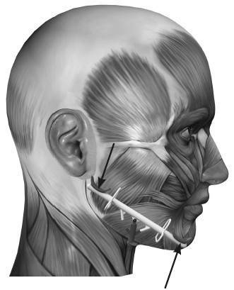 Иллюстрация к книге — Биогимнастика для лица: система фейсмионика [i_042.jpg]