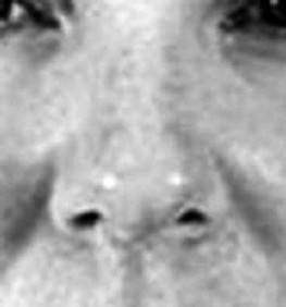 Иллюстрация к книге — Биогимнастика для лица: система фейсмионика [i_045.jpg]