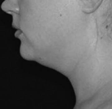 Иллюстрация к книге — Биогимнастика для лица: система фейсмионика [i_066.jpg]