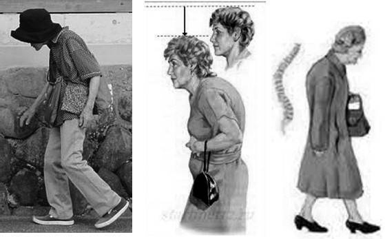 Иллюстрация к книге — Биогимнастика для лица: система фейсмионика [i_076.jpg]