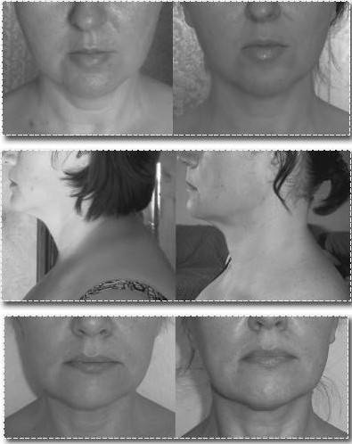 Иллюстрация к книге — Биогимнастика для лица: система фейсмионика [i_100.jpg]