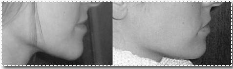 Иллюстрация к книге — Биогимнастика для лица: система фейсмионика [i_102.jpg]