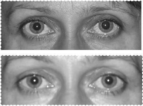 Иллюстрация к книге — Биогимнастика для лица: система фейсмионика [i_106.jpg]