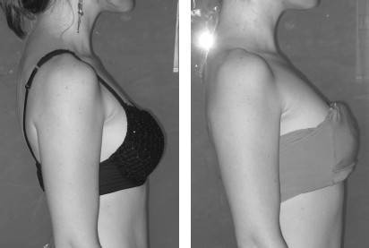 Иллюстрация к книге — Биогимнастика для лица: система фейсмионика [i_111.jpg]