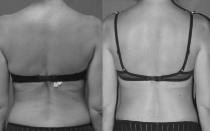 Иллюстрация к книге — Биогимнастика для лица: система фейсмионика [i_112.jpg]